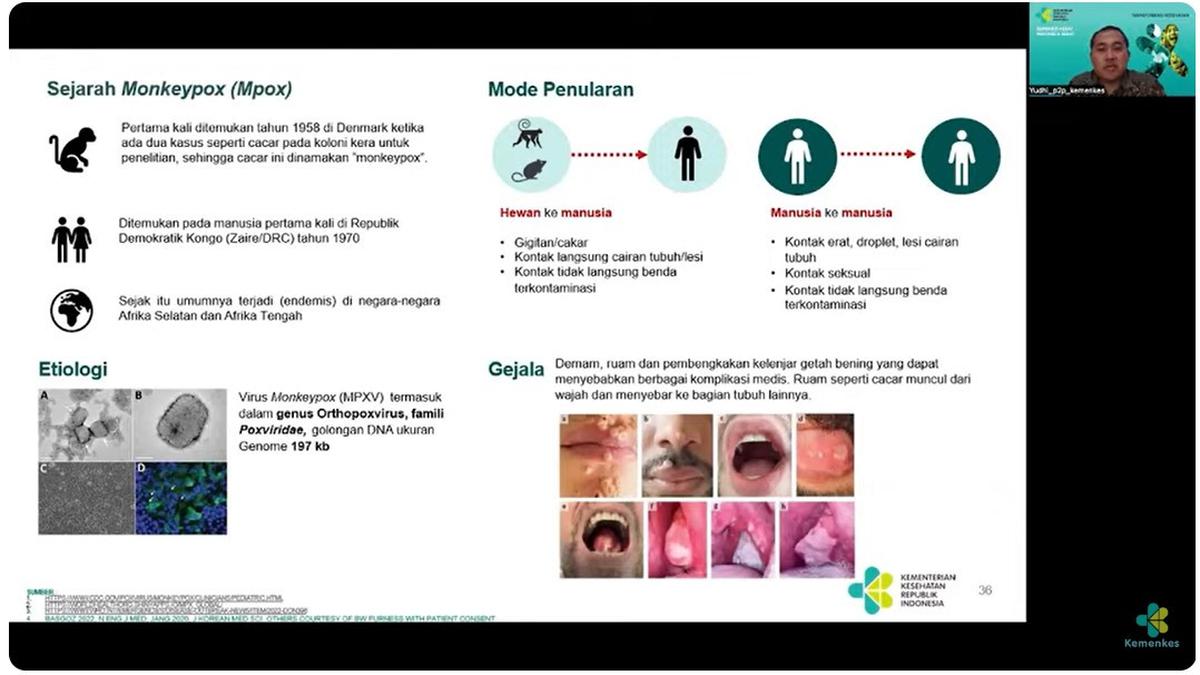 Kemenkes RI Perketat Gerbang Masuk, Mencegah Virus Mpox Varian Ganas Menyusup ke Indonesia